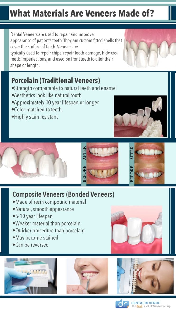 What Materials Are Veneers Made From Infographic