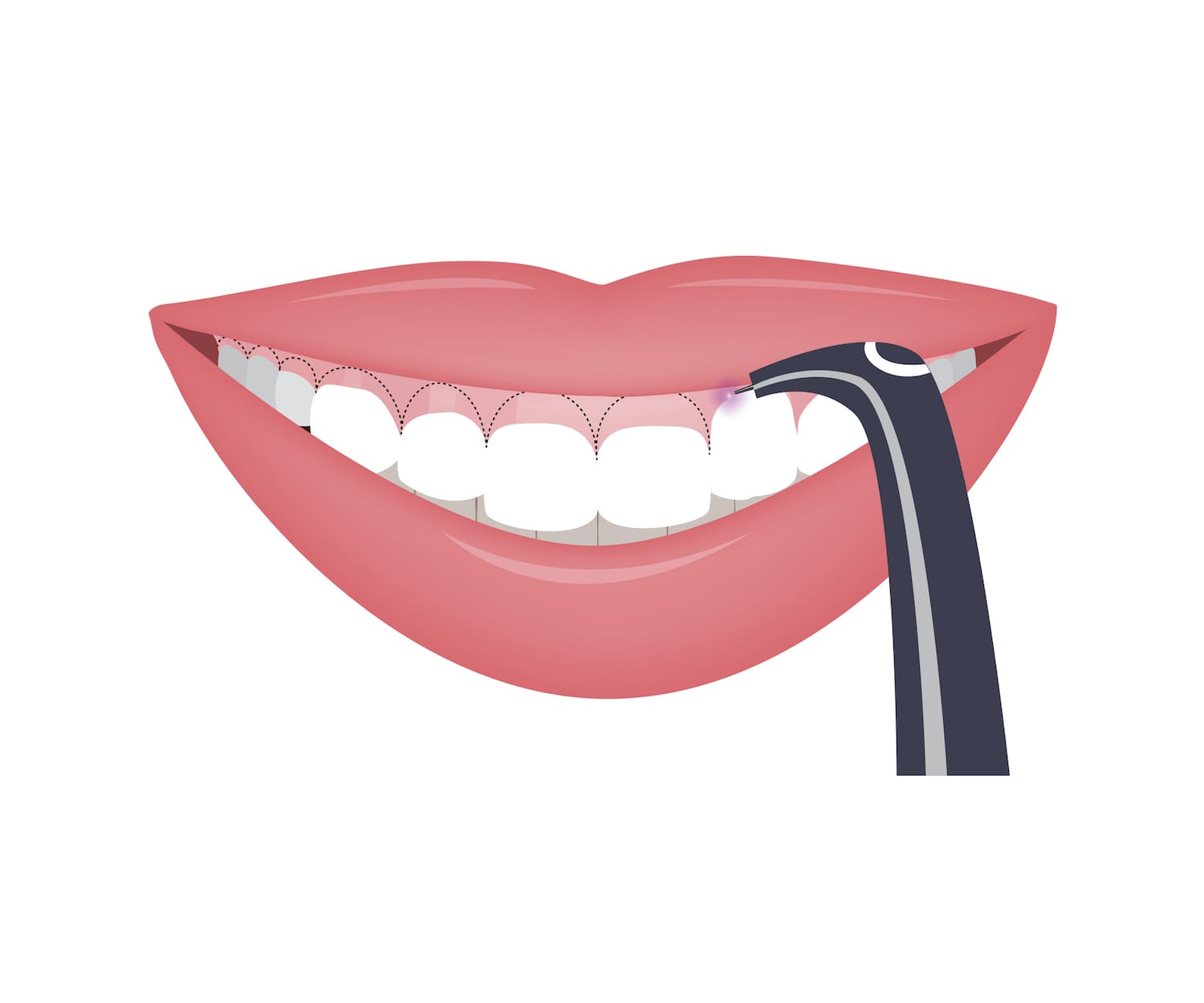 What Can Laser Dentistry Treat?