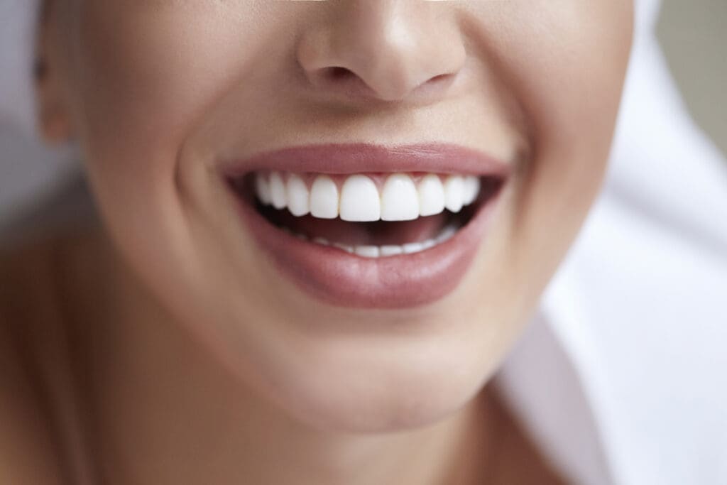 Porcelain Veneers in Durham NC