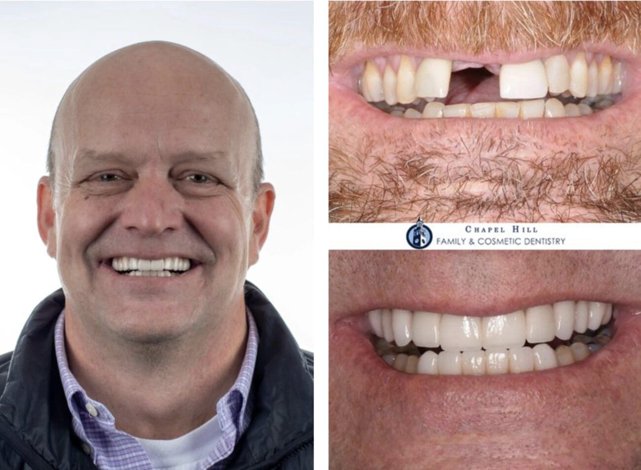 Fix your cosmetic dental issues at Chapel Hill Family & Cosmetic Dentistry