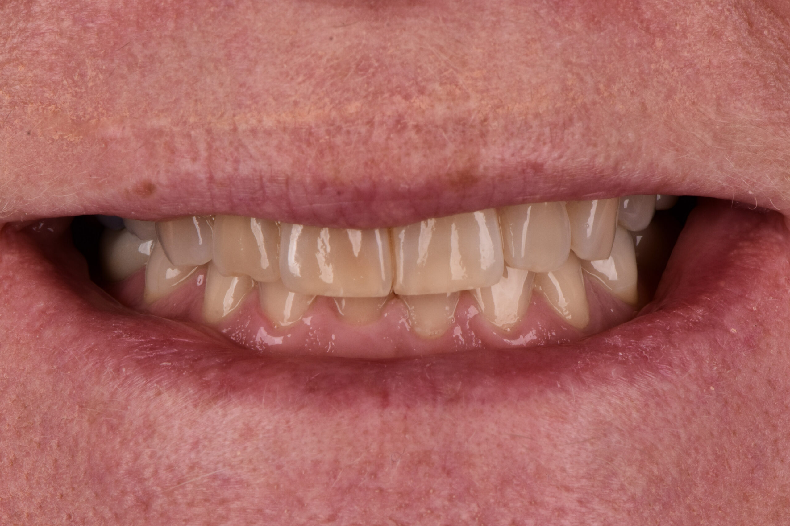 2-DSC_7637 2-DSC_7637